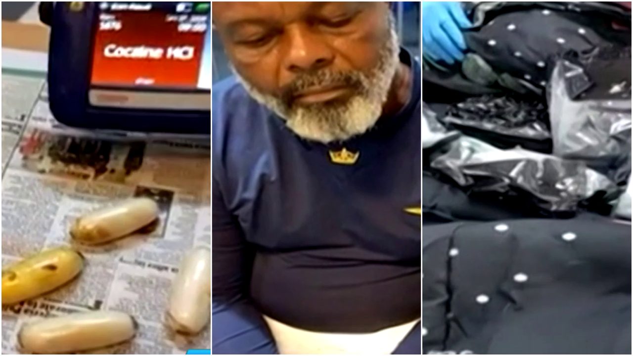NDLEA Arrests Man, Undergoes Surgery To Remove 81 Wraps Of Cocaine