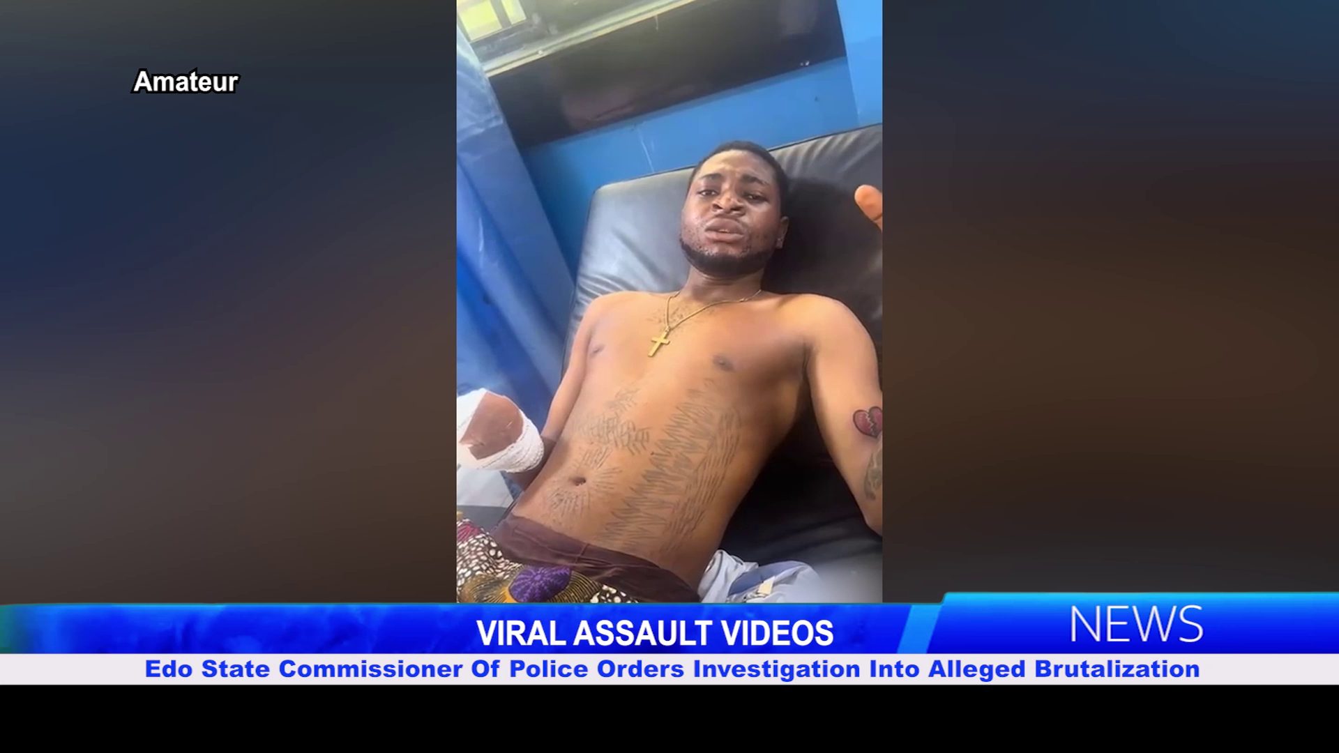 VIRAL ASSAULT VIDEOS: Edo State Commissioner Of Police Orders Investigation Into Alleged Brutalization Of Young Man