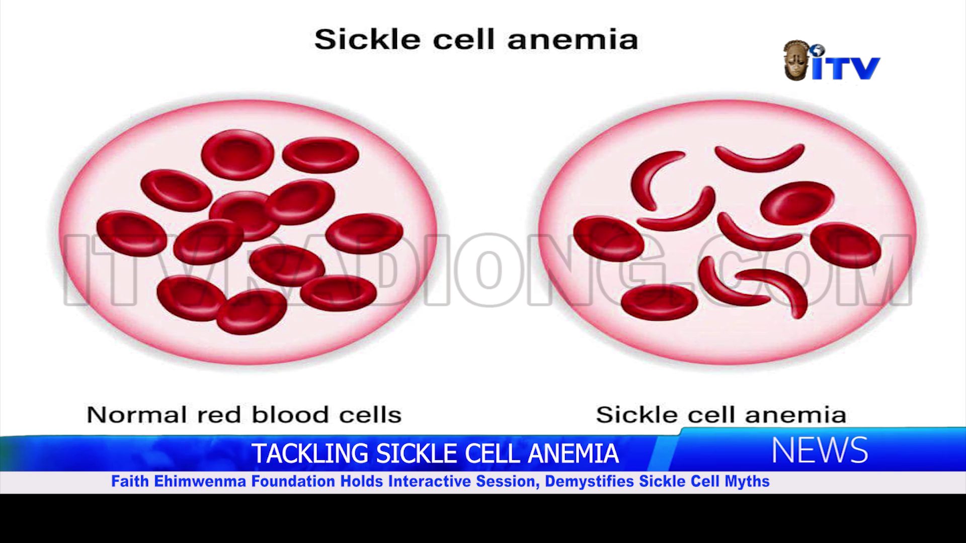TACKLING SICKLE CELL ANEMIA: Faith Ehimwenma Foundation Holds Interactive Session, Demystifies Sickle Cell Myths